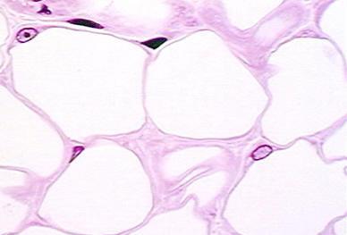 Unilocular Multilocular A