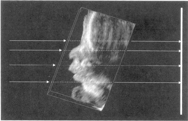 Visualização 3D Image showing the ray-casting approach.