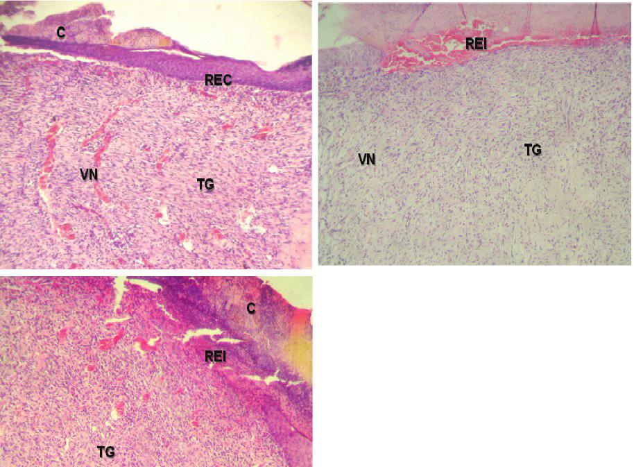 ACTA SCIENTIA BIOLOGICA 22 Figura 9 - Fotomicrografias de cortes de pele mostrando em A (tratamento com pasta de figo), B (tratamento com dersani) e C (tratamento com soro,9) crosta