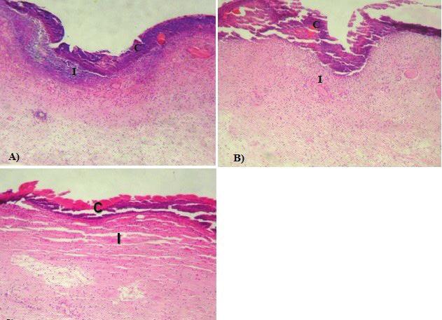ACTA SCIENTIA BIOLOGICA Resultados e discussão Após 24h de tratamento com solução salina,9, dersani e figo, todas as lesões apresentaram características histopatológicas semelhantes, tais como a