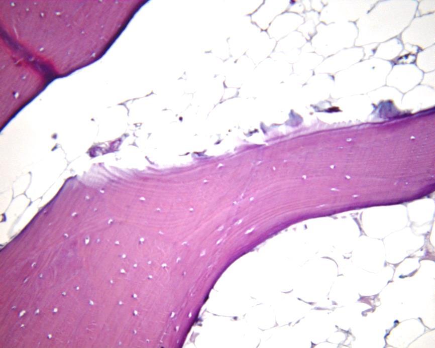 Osso Compacto Trabécula óssea Osteócitos Canal medular