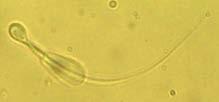 Células espermáticas com morfologia anormal Figura 03: Espermatozóide com gota