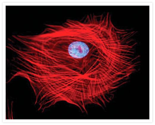 A faloidina impede a despolimerização da actina Muntjac skin fibroblast labeled with rhodamine phalloidin.