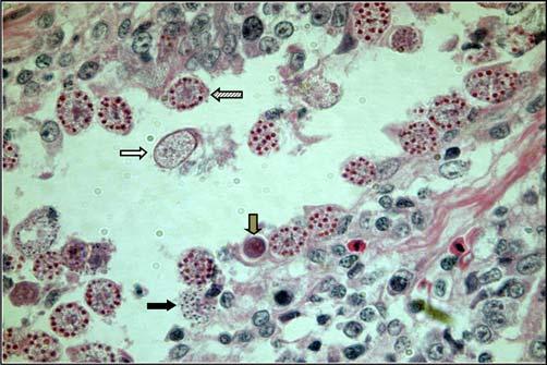 18 Freitas et al. Figura 2. Áreas avermelhadas na região duodenal observada no 3º (a) e 9º dias após imfecção (b) em frangos inoculados com 1x10 6 oocistos de Eimeria acervulina. Figua 3.