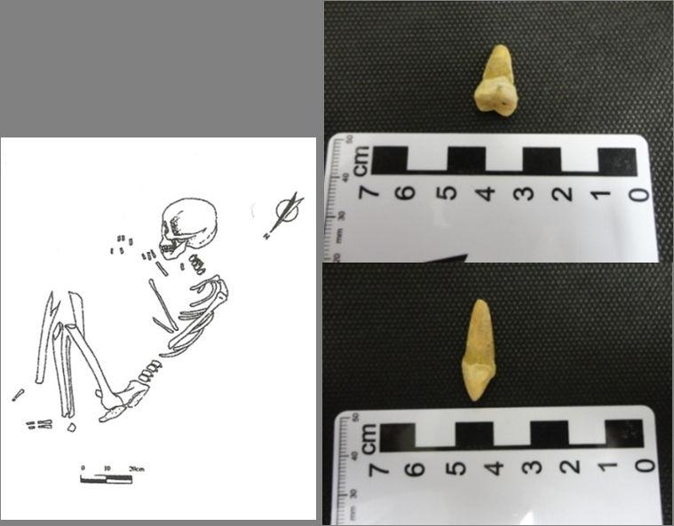 Sítio Justino C (Sepultura 107) Para a sepultura 107 localizada na camada 19 coletaram-se dois dentes molares em ótimo estado de conservação.
