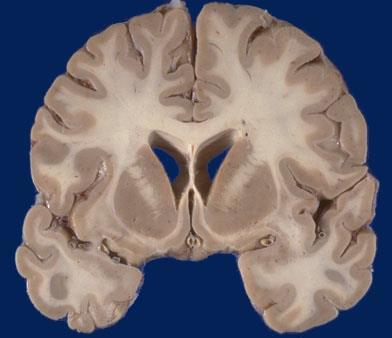 CÓRTEX CEREBRAL ESTRUTURA HISTOLÓGICA DO CÓRTEX CONTÉM CORPOS DE NEURÔNIOS, DENDRITOS E CONEXÕES SINÁPTICAS BOA