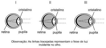 a) 100,5 e 100,5. b) 100,75 e 100,5. c) 100,75 e 100,50. d) 101,50 e 101,00. e) 101,50 e 100,50.