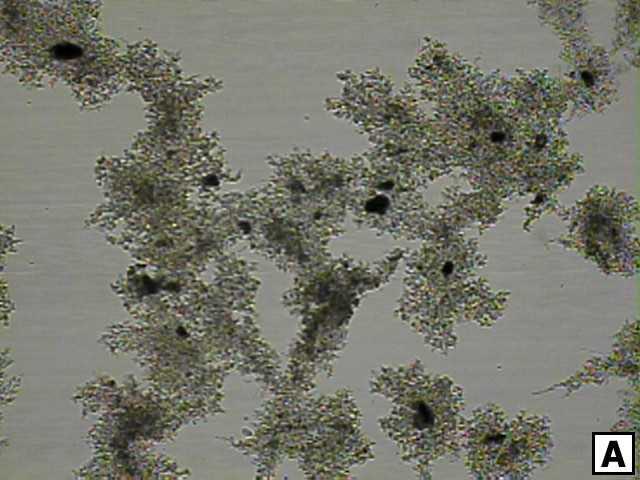 Figura 9. Microfotografias do lodo biológico nos reatores durante a primeira etapa de operação em regime contínuo.