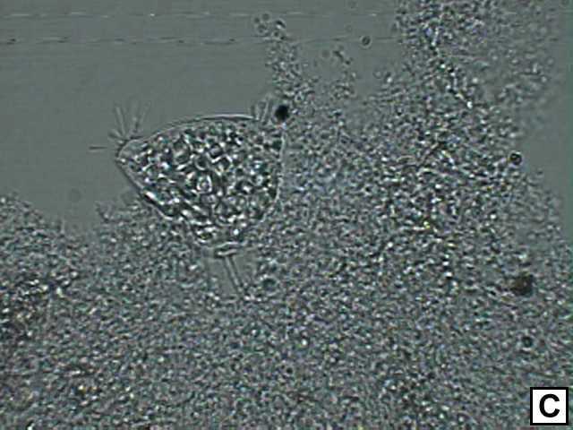 (E) presença do ciliado livrenatante do gênero Paramecium no reator operado a 35 C, aumento de 1000 vezes.