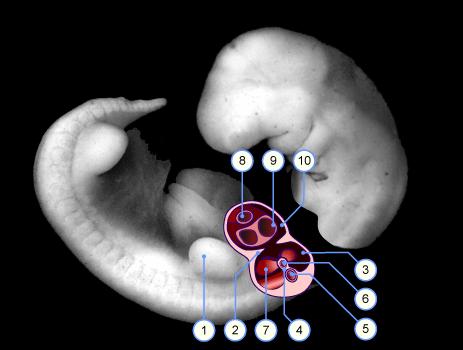 A membrana visceral deriva do ESPLÂNCNICO A membrana parietal deriva do SOMÁTICO