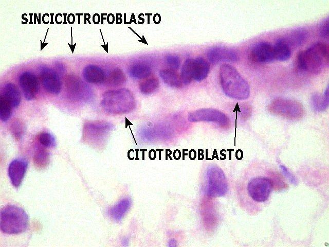 sinciciotrofoblasto