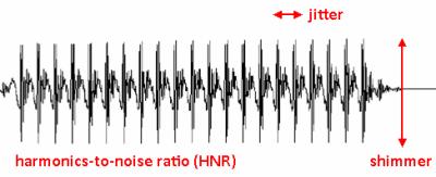 18 das estruturas ou, ainda, na atividade muscular ou neural envolvida. O jitter não define a causa da disfonia, mas reflete a extensão da alteração encontrada. (BAKEN, 1987; BEHLAU et al, 2001).