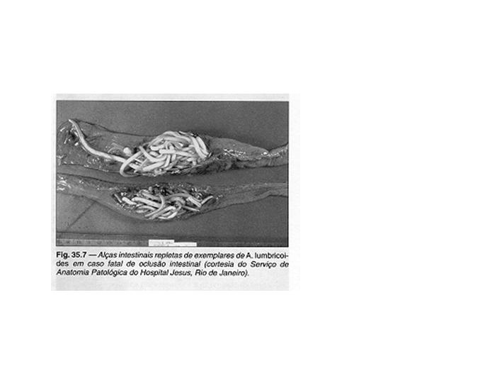 Patogenia PRESENÇA DOS VERMES ADULTOS Vermes Adultos depende do número Baixa (3-4 vermes) Média (30-40 vermes) Alta (>100