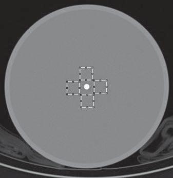 Otimização da dose em tomografia computadorizada os demais parâmetros (espessura do corte, pitch, tamanho do pixel e exposição total) foram mantidos constantes para cada protocolo, conforme está