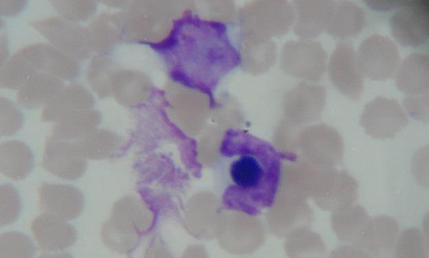 mórulas de Anaplasmaplatys são encontradas incidentalmente devido à parasitemia ser cíclica (INOKUMA et al., 2002).