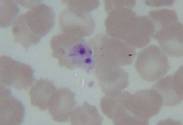 Figura 2. Anaplasmasp. observada na pesquisa de hemoparasitas em microscopia óptica em objetiva de imersão (1000x). Figura 3. Babesiasp.