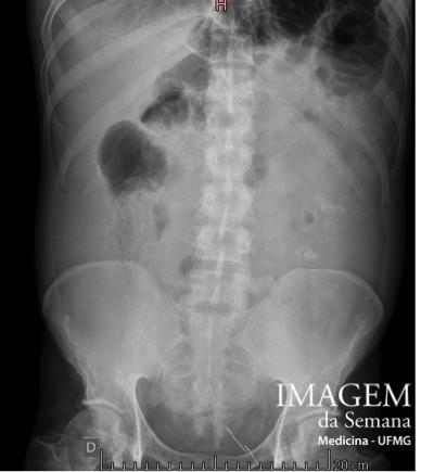 01. Radiografia simples de