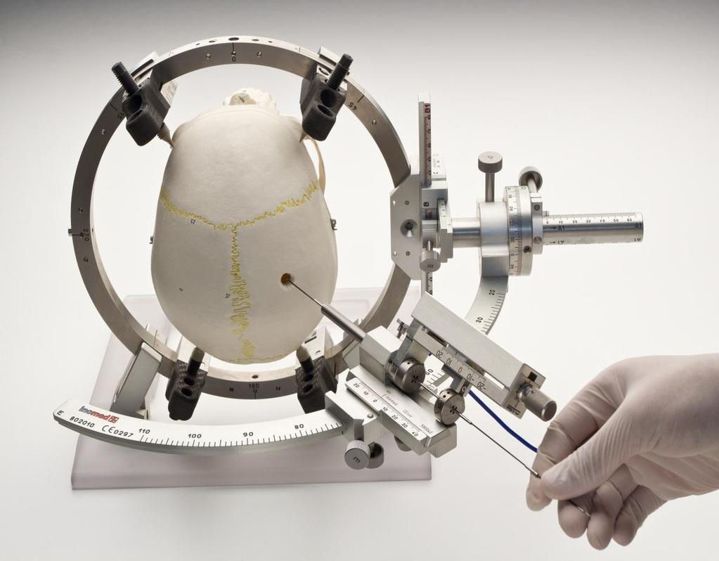 SISTEMA ESTEREOTAXICO ZD O SISTEMA ESTREOTAXICO ZD O ESTEREOTAXICO ZD é um avançado dispositivo para Neurocirurgias baseadas em