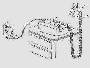 Cpap e apnéia do sono A forma mais conservadora de tratamento das apnéias do sono e da hipoventilação da obesidade é também a mais bem aceita pelos pacientes.