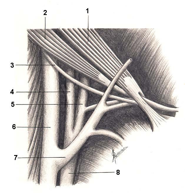 Os Trígonos de Farabeuf e de Guyon e suas relações anatômicas, na profundidade, com as artérias: Carótida Interna ( 4 ) e Carótida Externa ( 5 ). LEGENDA: FIG.02 1. Músculo estilo-hióideo 5.