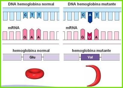 Anemia Falciforme Hemáceas normais Causa: