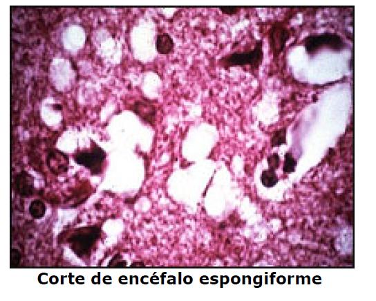 Pertencentes ao Grupo das encefalopatias espongiformes transmissíveis também conhecidas como doenças do prion,onde provocam degenerações fatais do cérebro resultando em danos neuronais devido ao seu