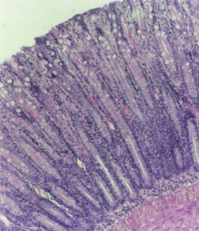 EPITÉLIO GLANDULAR Em alguns epitélios de revestimento, há a presença de células secretoras que são consideradas glândulas unicelulares, como as células caliciformes no epitélio dos intestinos e da