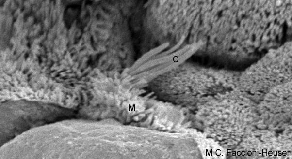 Os cílios são projeções da superfície apical maiores que os microvilos: cerca de 250nm de diâmetro e 5 a 10 m de comprimento.