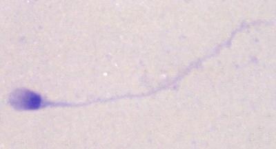 Flagelo Figura 2.10 - Fotomicrografia de espermatozoide humano. Giemsa.