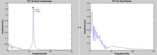 Após a aplicação da FFT (Fast Fourier Transform), as figuras 4 e 4 apresentam, respectivamente, os espectros de amplitude dos sinais com o ruído de 60Hz e após a aplicação do filtro Notch.