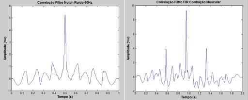 contaminado, conforme mostra a Figura 8, observa-se a predominância de dois picos próximos às frequências de 30 Hz e 45 Hz.
