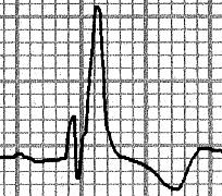 ou linear T AFC 100% no