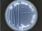 aureus Bacillus cereus Escherichia