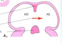 foramen oval (pressão no A.D. > A.E.