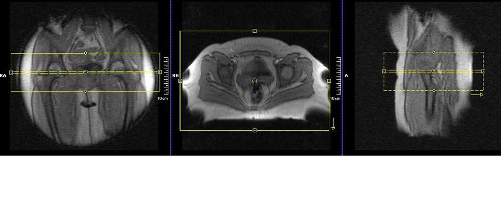 Rotina com FOV 220 PROGRAMAÇÃO PLANO CORONAL Cortes orientados em