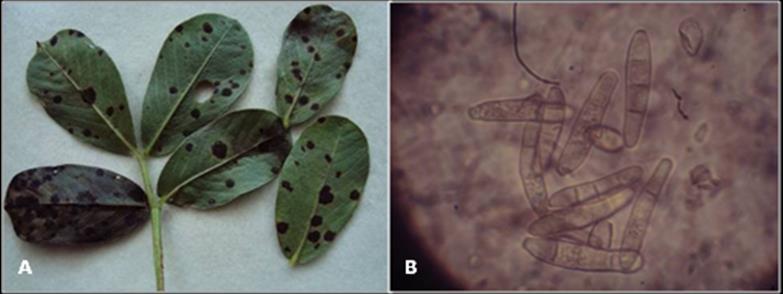 Figura 2. Mancha castanha em folíolos de amendoim, causada por Passalora arachidicola: A.