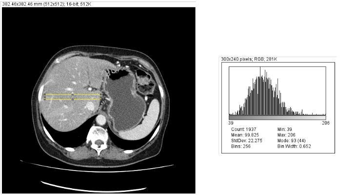 42 Processamento automático de imagens DICOM para otimização de doses em exames de Tomografia Computorizada Figura 14 - Distribuição Gaussiana (Imagem adaptada de Digital Image Processing,2008).