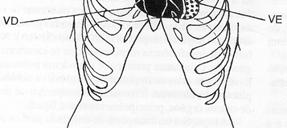 Ovalle Ausculta Análise de um sintoma Semiologia cardiovascular Início: gradual, súbito Freqüência Intensidade Evolução: