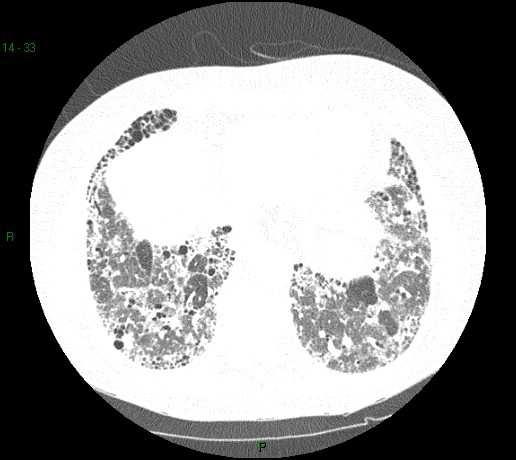 anos (cirurgia,