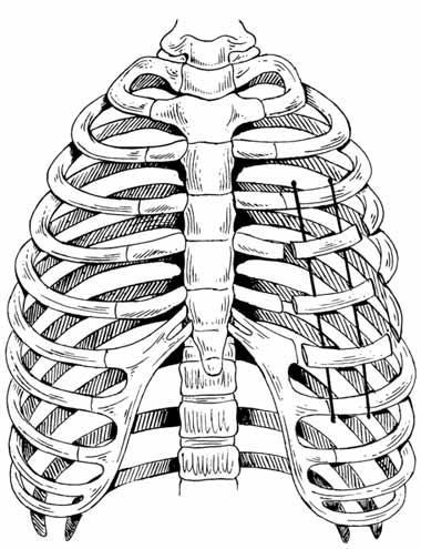 Trinkle et al.