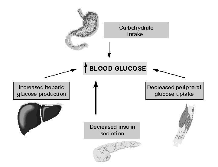 Ingestão de hidratos de carbono Aumento da glicose no sangue Aumento da produção hepática de glicose Diminuição da captação de glicose periférica Diminuição da secreção de insulina Figura 4 -