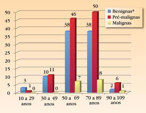 Cento e catorze lesões (51,35%) eram pré-malignas e 16 (7,21%), malignas (Tabela1).