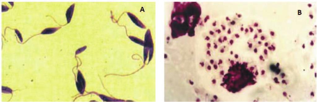 4 A Leishmania chagasi é um parasita intracelular obrigatório das células do sistema fagocítico mononuclear, possui forma flagelada ou promastigota encontrada no tubo digestivo do inseto vetor e