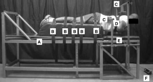 da coluna lombar (discos intervertebrais, cápsulas e ligamentos) promovendo a deformação plástica destas estruturas sensíveis à distensão, e conseqüentemente, a dor lombar (7).