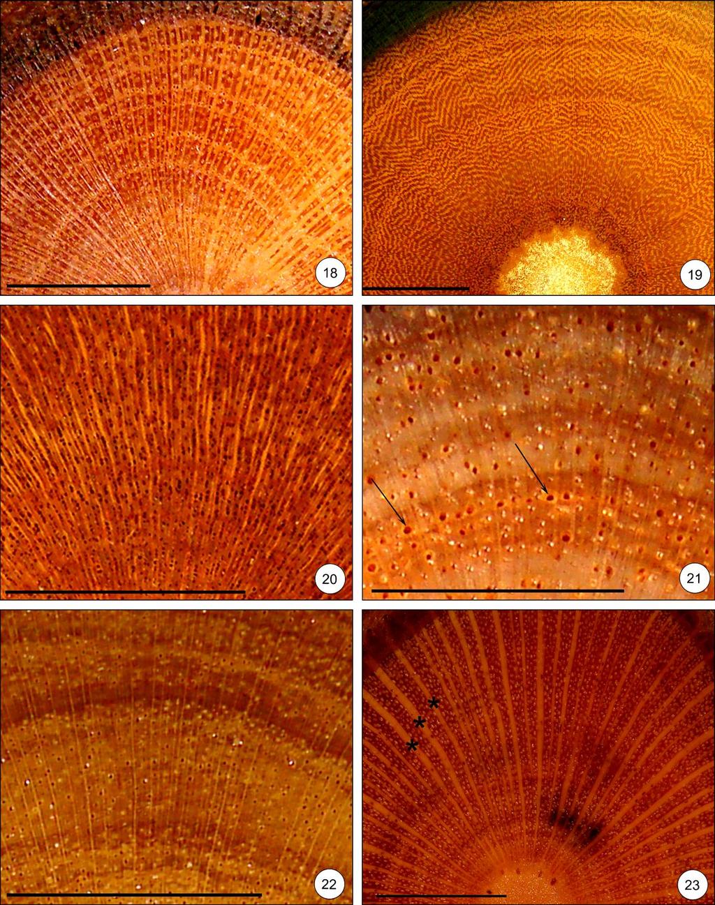Figuras 18-23. Seção transversal. 18. Vasos em arranjo tangencial em Piptocarpha rotundifolia. 19. Vasos em arranjo diagonal em Gochnatia polimorpha (ZR). 20.