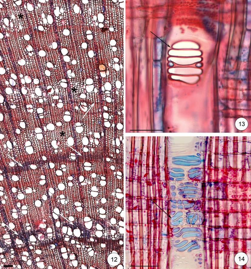Figura 12-14. Características das espécies da Zona ripária. 12. Faixas de fibras semelhantes ao parênquima axial (*), fibras gelatinosas (setas) e parênquima axial escasso em Persea venosa, seção transversal.