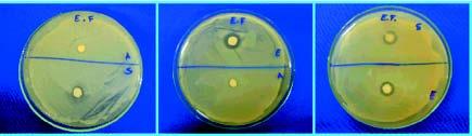 Figura 3 Corpos de Enterococcus