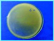 Figura 4 Corpos de Staphylococcus