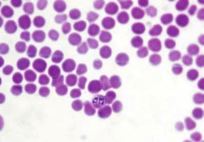 38 Capítulo 3 Principais doenças transmitidas por carrapatos no Brasil rapato (HERNDON et al., 2010).