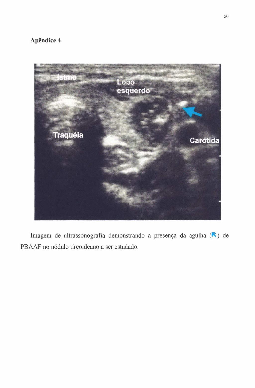 so Apêndice 4 Imagem de ultrassonografia demonstrando a
